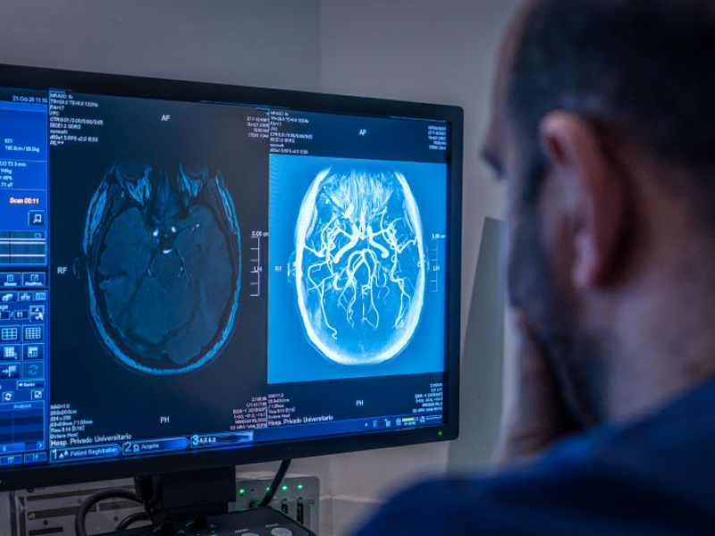 Accidente cerebrovascular: la importancia de reconocer las señales de alerta - Hospital Privado Cordoba