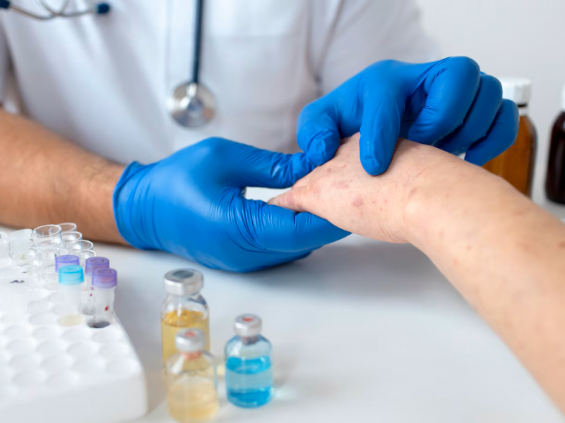 Sífilis: una infección de transmisión sexual en aumento - Hospital Privado Cordoba