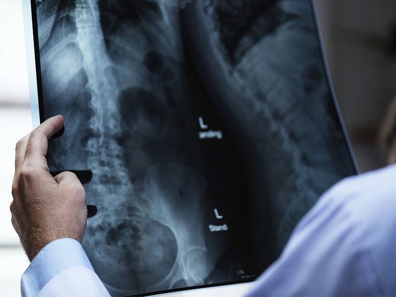 Traumatología y Ortopedia reconocidos por la AAOT - Hospital Privado Cordoba