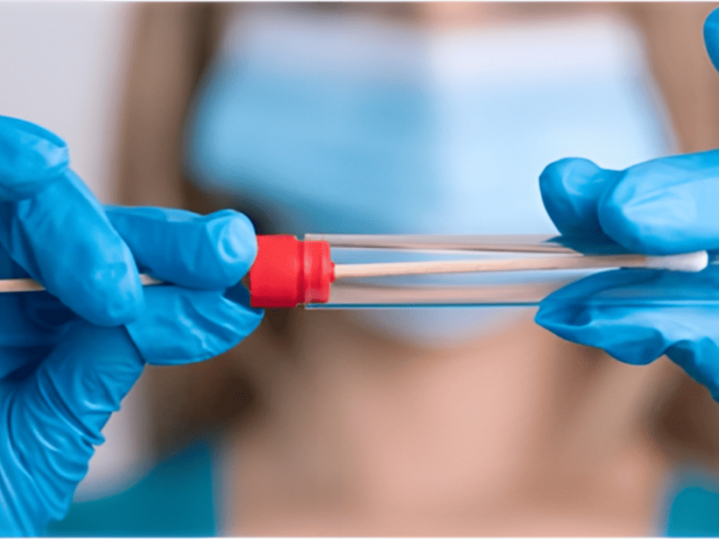 Test de HPV: una herramienta clave para prevenir el cáncer de cuello uterino - Hospital Privado Cordoba