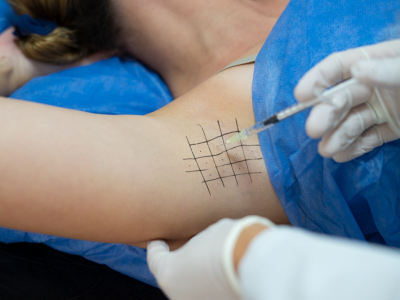 Hiperhidrosis: qué hacer cuando la sudoración es excesiva - Hospital Privado Cordoba