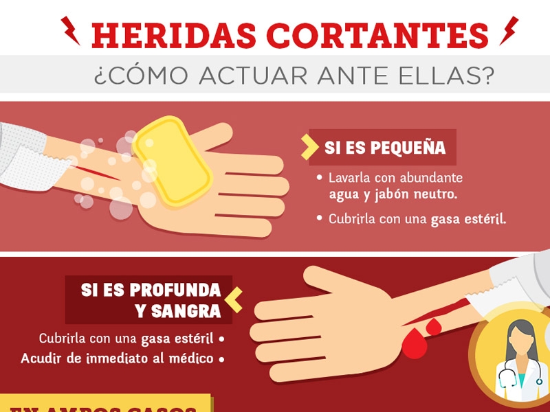 ¿Qué hacer ante una herida cortante? - Hospital Privado Cordoba