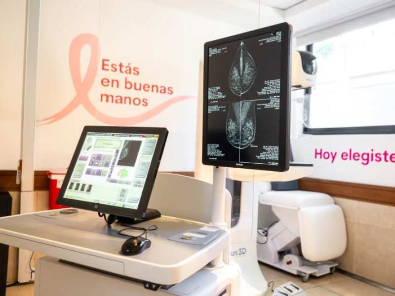 Mamografía: una herramienta clave para la detección temprana del cáncer de mama - Hospital Privado Cordoba