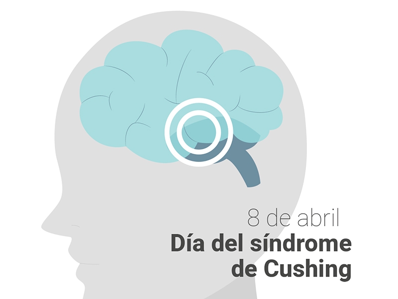 Síndrome de Cushing: la importancia de visibilizar una enfermedad poco frecuente - Hospital Privado Cordoba