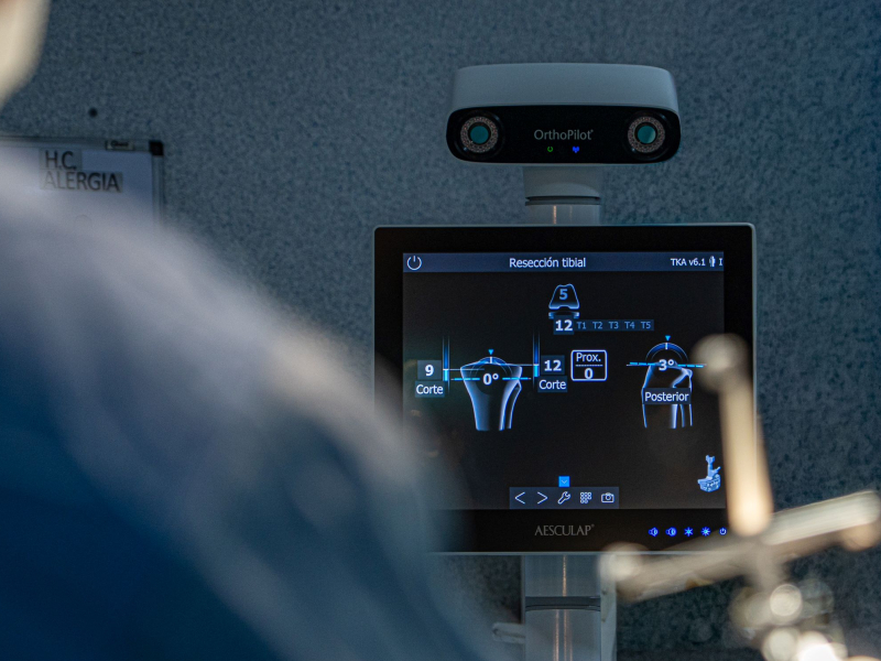 Nuevo navegador de rodilla en Hospital Privado: innovación y mayor precisión - Hospital Privado Cordoba