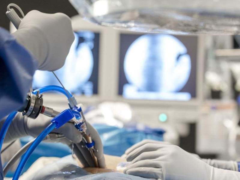 Cirugía innovadora para patologías de columna - Hospital Privado Cordoba