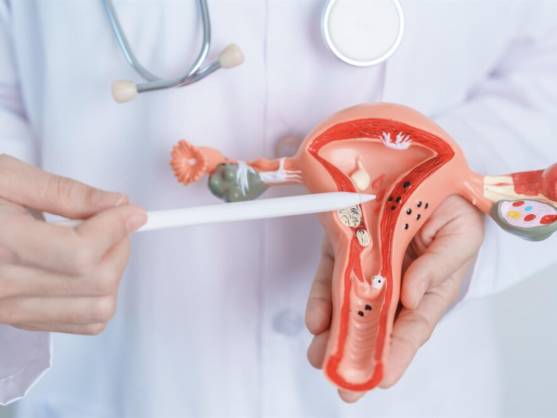 Cáncer de cuello de útero: una enfermedad prevenible y detectable a tiempo  - Hospital Privado Cordoba